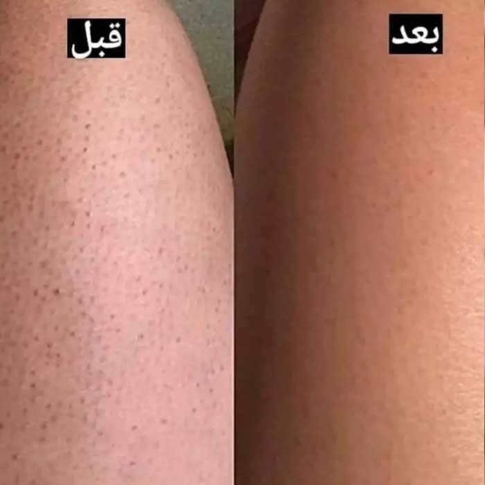 تصویر نمک بدن هلو آبرسان پوست 